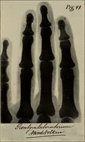 An illustration from Röntgentechniek : therapeutische beteekenis der "X" -stralen en der stoomen van hooge fréquentie (1904)