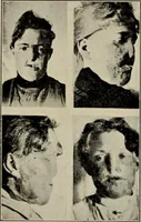 An illustration from Röntgentechniek : therapeutische beteekenis der "X" -stralen en der stoomen van hooge fréquentie (1904)