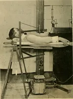An illustration from The Roentgen rays in medicine and surgery as an aid in diagnosis and as a therapeutic agent : designed for the use of practitioners and students (1901)