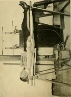 An illustration from The Roentgen rays in medicine and surgery as an aid in diagnosis and as a therapeutic agent : designed for the use of practitioners and students (1901)