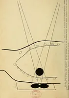 An illustration from The Roentgen rays in medicine and surgery as an aid in diagnosis and as a therapeutic agent : designed for the use of practitioners and students (1901)