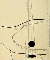 An illustration from The Roentgen rays in medicine and surgery as an aid in diagnosis and as a therapeutic agent : designed for the use of practitioners and students (1901)