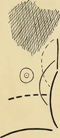 An illustration from The Roentgen rays in medicine and surgery as an aid in diagnosis and as a therapeutic agent : designed for the use of practitioners and students (1901)