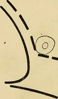An illustration from The Roentgen rays in medicine and surgery as an aid in diagnosis and as a therapeutic agent : designed for the use of practitioners and students (1901)