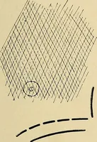 An illustration from The Roentgen rays in medicine and surgery as an aid in diagnosis and as a therapeutic agent : designed for the use of practitioners and students (1901)