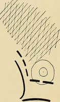 An illustration from The Roentgen rays in medicine and surgery as an aid in diagnosis and as a therapeutic agent : designed for the use of practitioners and students (1901)