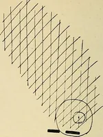 An illustration from The Roentgen rays in medicine and surgery as an aid in diagnosis and as a therapeutic agent : designed for the use of practitioners and students (1901)