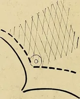 An illustration from The Roentgen rays in medicine and surgery as an aid in diagnosis and as a therapeutic agent : designed for the use of practitioners and students (1901)