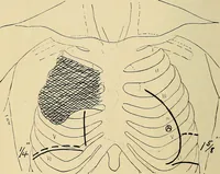 An illustration from The Roentgen rays in medicine and surgery as an aid in diagnosis and as a therapeutic agent : designed for the use of practitioners and students (1901)