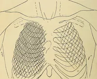 An illustration from The Roentgen rays in medicine and surgery as an aid in diagnosis and as a therapeutic agent : designed for the use of practitioners and students (1901)