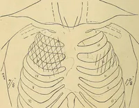 An illustration from The Roentgen rays in medicine and surgery as an aid in diagnosis and as a therapeutic agent : designed for the use of practitioners and students (1901)