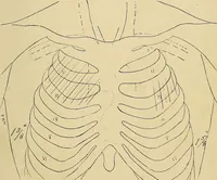 An illustration from The Roentgen rays in medicine and surgery as an aid in diagnosis and as a therapeutic agent : designed for the use of practitioners and students (1901)
