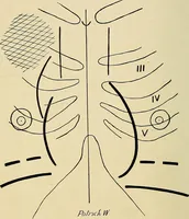 An illustration from The Roentgen rays in medicine and surgery as an aid in diagnosis and as a therapeutic agent : designed for the use of practitioners and students (1901)