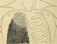 An illustration from The Roentgen rays in medicine and surgery as an aid in diagnosis and as a therapeutic agent : designed for the use of practitioners and students (1901)