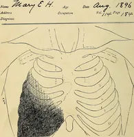 An illustration from The Roentgen rays in medicine and surgery as an aid in diagnosis and as a therapeutic agent : designed for the use of practitioners and students (1901)