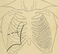 An illustration from The Roentgen rays in medicine and surgery as an aid in diagnosis and as a therapeutic agent : designed for the use of practitioners and students (1901)