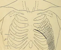An illustration from The Roentgen rays in medicine and surgery as an aid in diagnosis and as a therapeutic agent : designed for the use of practitioners and students (1901)