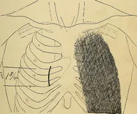An illustration from The Roentgen rays in medicine and surgery as an aid in diagnosis and as a therapeutic agent : designed for the use of practitioners and students (1901)