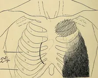 An illustration from The Roentgen rays in medicine and surgery as an aid in diagnosis and as a therapeutic agent : designed for the use of practitioners and students (1901)