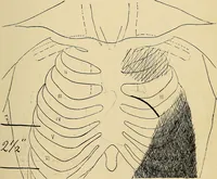 An illustration from The Roentgen rays in medicine and surgery as an aid in diagnosis and as a therapeutic agent : designed for the use of practitioners and students (1901)