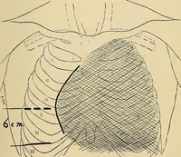 An illustration from The Roentgen rays in medicine and surgery as an aid in diagnosis and as a therapeutic agent : designed for the use of practitioners and students (1901)