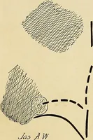 An illustration from The Roentgen rays in medicine and surgery as an aid in diagnosis and as a therapeutic agent : designed for the use of practitioners and students (1901)
