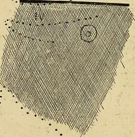 An illustration from The Roentgen rays in medicine and surgery as an aid in diagnosis and as a therapeutic agent : designed for the use of practitioners and students (1901)