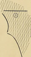 An illustration from The Roentgen rays in medicine and surgery as an aid in diagnosis and as a therapeutic agent : designed for the use of practitioners and students (1901)