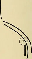 An illustration from The Roentgen rays in medicine and surgery as an aid in diagnosis and as a therapeutic agent : designed for the use of practitioners and students (1901)