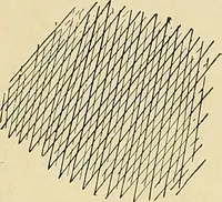 An illustration from The Roentgen rays in medicine and surgery as an aid in diagnosis and as a therapeutic agent : designed for the use of practitioners and students (1901)