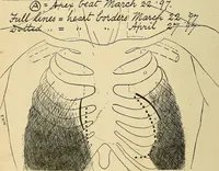 An illustration from The Roentgen rays in medicine and surgery as an aid in diagnosis and as a therapeutic agent : designed for the use of practitioners and students (1901)