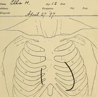 An illustration from The Roentgen rays in medicine and surgery as an aid in diagnosis and as a therapeutic agent : designed for the use of practitioners and students (1901)
