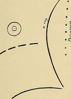 An illustration from The Roentgen rays in medicine and surgery as an aid in diagnosis and as a therapeutic agent : designed for the use of practitioners and students (1901)