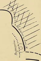 An illustration from The Roentgen rays in medicine and surgery as an aid in diagnosis and as a therapeutic agent : designed for the use of practitioners and students (1901)