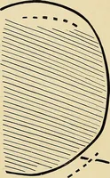 An illustration from The Roentgen rays in medicine and surgery as an aid in diagnosis and as a therapeutic agent : designed for the use of practitioners and students (1901)
