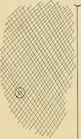 An illustration from The Roentgen rays in medicine and surgery as an aid in diagnosis and as a therapeutic agent : designed for the use of practitioners and students (1901)