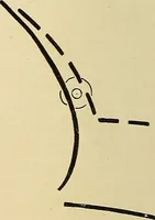 An illustration from The Roentgen rays in medicine and surgery as an aid in diagnosis and as a therapeutic agent : designed for the use of practitioners and students (1901)
