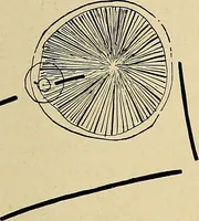 An illustration from The Roentgen rays in medicine and surgery as an aid in diagnosis and as a therapeutic agent : designed for the use of practitioners and students (1901)