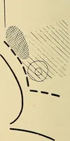 An illustration from The Roentgen rays in medicine and surgery as an aid in diagnosis and as a therapeutic agent : designed for the use of practitioners and students (1901)