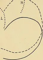 An illustration from The Roentgen rays in medicine and surgery as an aid in diagnosis and as a therapeutic agent : designed for the use of practitioners and students (1901)