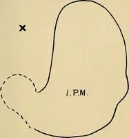 An illustration from The Roentgen rays in medicine and surgery as an aid in diagnosis and as a therapeutic agent : designed for the use of practitioners and students (1901)