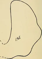 An illustration from The Roentgen rays in medicine and surgery as an aid in diagnosis and as a therapeutic agent : designed for the use of practitioners and students (1901)
