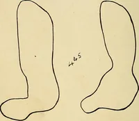 An illustration from The Roentgen rays in medicine and surgery as an aid in diagnosis and as a therapeutic agent : designed for the use of practitioners and students (1901)