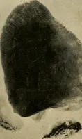 An illustration from The Roentgen rays in medicine and surgery as an aid in diagnosis and as a therapeutic agent : designed for the use of practitioners and students (1901)
