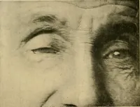 An illustration from The Roentgen rays in medicine and surgery as an aid in diagnosis and as a therapeutic agent : designed for the use of practitioners and students (1901)