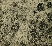 An illustration from The Roentgen rays in medicine and surgery as an aid in diagnosis and as a therapeutic agent : designed for the use of practitioners and students (1901)