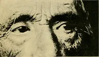 An illustration from The Roentgen rays in medicine and surgery as an aid in diagnosis and as a therapeutic agent : designed for the use of practitioners and students (1901)