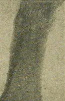 An illustration from The Roentgen rays in medicine and surgery as an aid in diagnosis and as a therapeutic agent : designed for the use of practitioners and students (1901)
