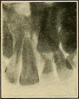 An illustration from The Roentgen rays in medicine and surgery as an aid in diagnosis and as a therapeutic agent : designed for the use of practitioners and students (1901)