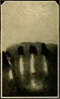 An illustration from The Roentgen rays in medicine and surgery as an aid in diagnosis and as a therapeutic agent : designed for the use of practitioners and students (1901)